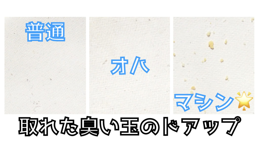 うがいで臭い玉がとれるのか 臭い玉除去 臭い玉をとる